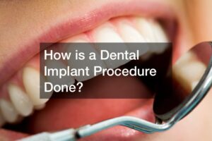 dental implants