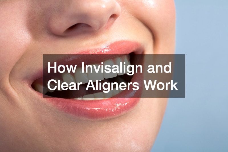 How Invisalign and Clear Aligners Work