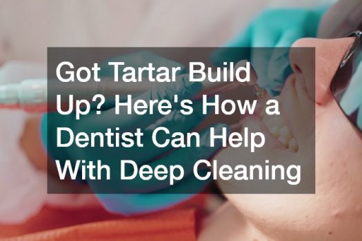 Got Tartar Build Up? Heres How a Dentist Can Help With Deep Cleaning