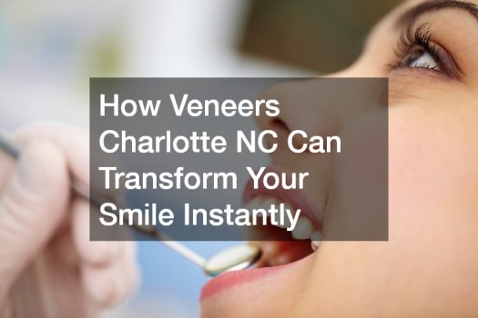 How Veneers Charlotte NC Can Transform Your Smile Instantly